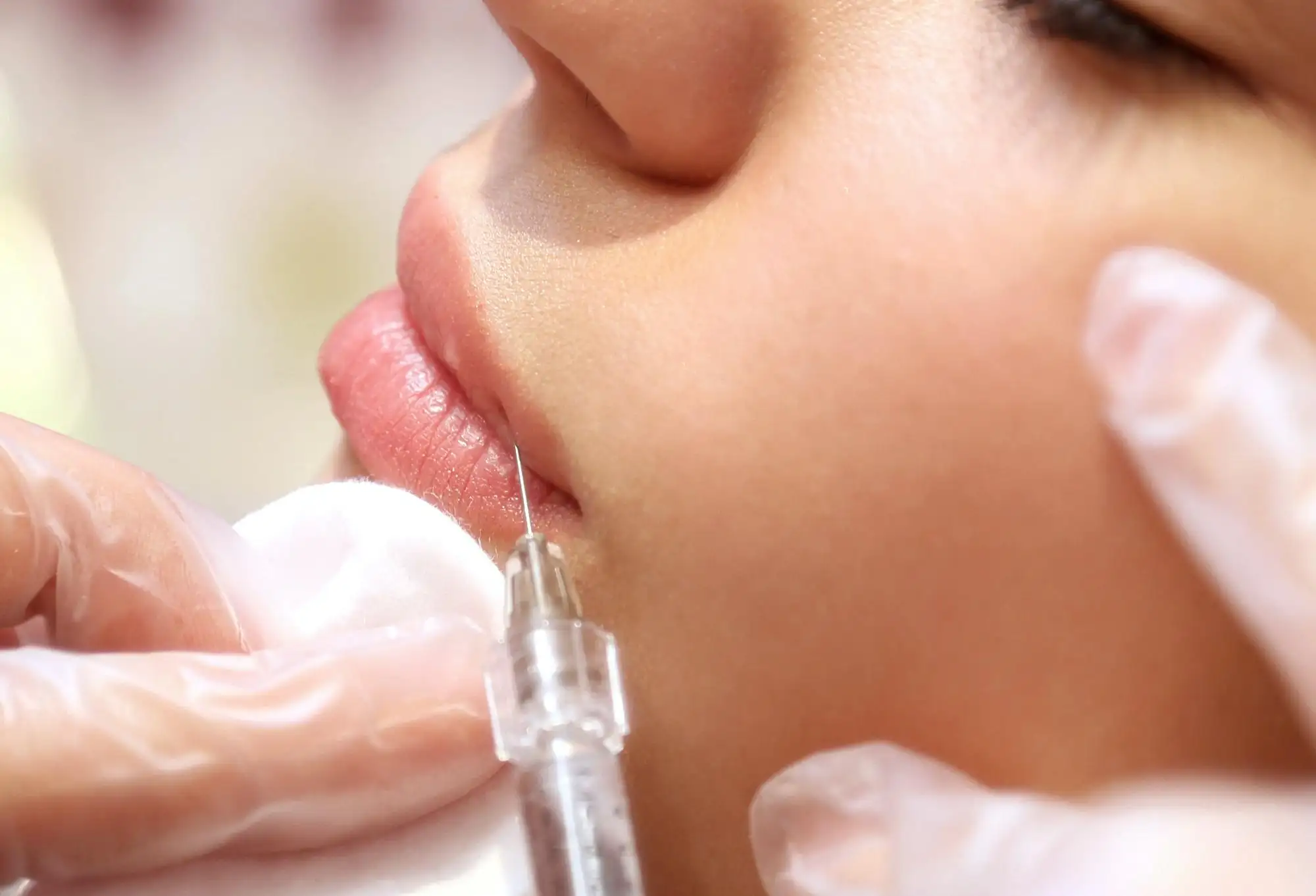 chirurgie reparatrice toulon acide