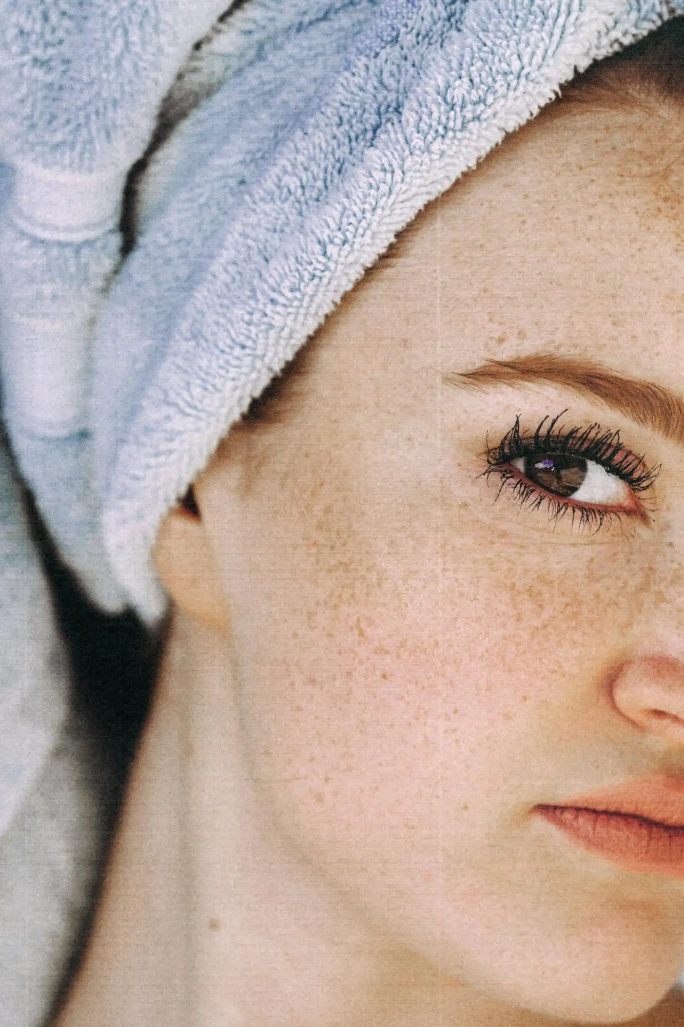 chirurgie esthetique toulon visage